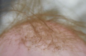 Baby Hair closeup